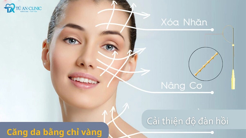 cang-da-chi-vang-webp-2-4 căng da chỉ vàng