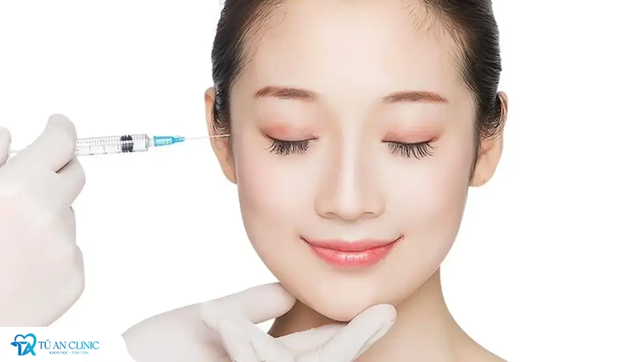 Có nên căng da thái dương không? 4 phương pháp căng da thái dương phổ biến nhất
