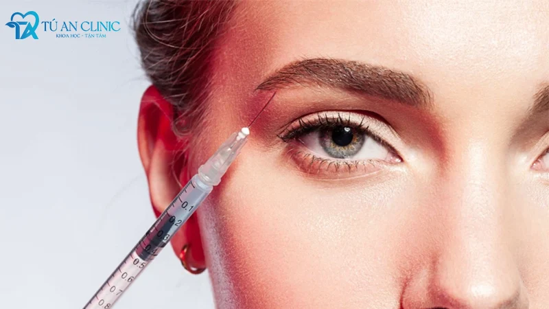 tiem-thai-duong-hop2 Tiêm filler thái dương là một phương pháp làm đẹp phổ biến hiện nay